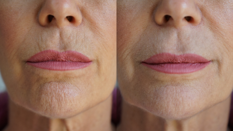 PRAI Ageless Lip & Line Filler – Plump & Smooth | Hallebeauty