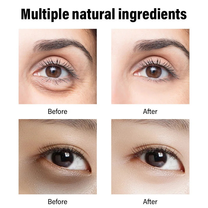 Retinol Eye Cream 30g: Fades Dark Circles & Fishtail Patterns - HalleBeauty