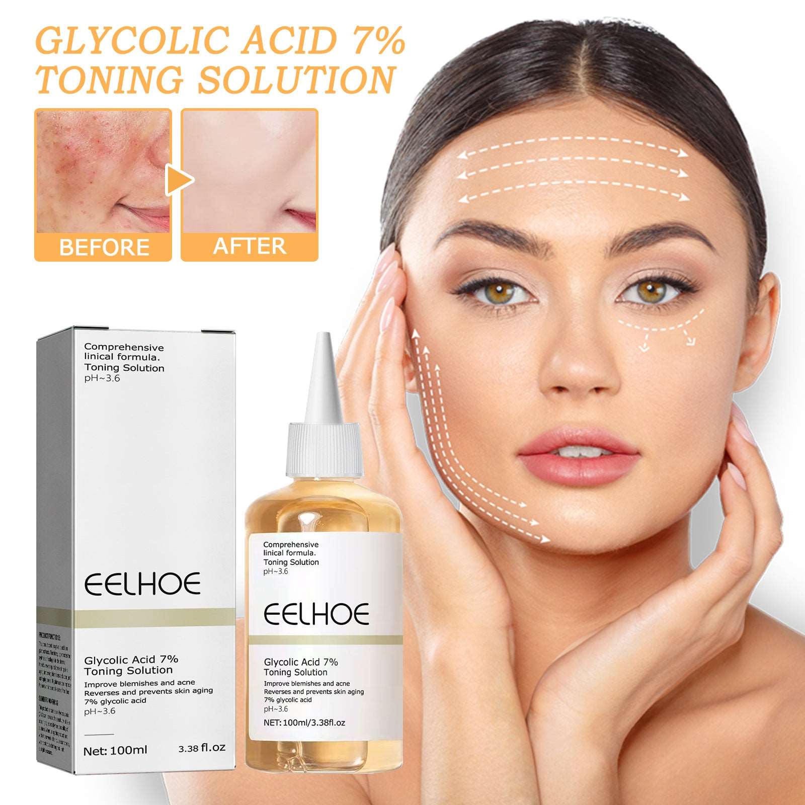 Glycolic Acid 7% Lotion: Acne Treatment & Pore Refining - HalleBeauty