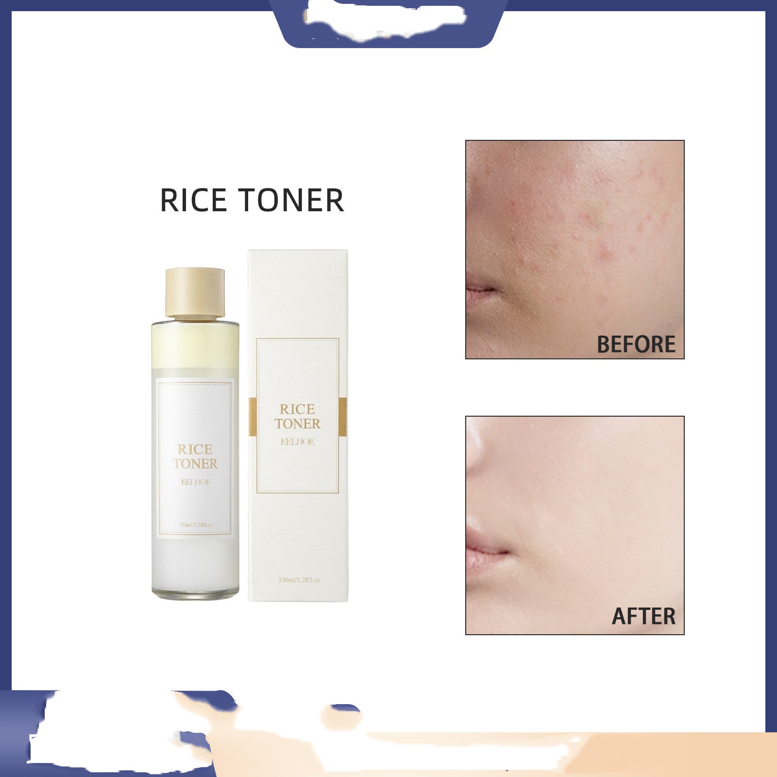 I'm From Rice Toner: Korean Rice Extract & Niacinamide for Hydrated, Glowing Skin - HalleBeauty