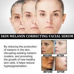 Melanin Repair Facial - Brighten & Even Tone - HalleBeauty