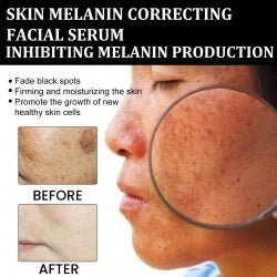 Melanin Repairing Facial - HalleBeauty