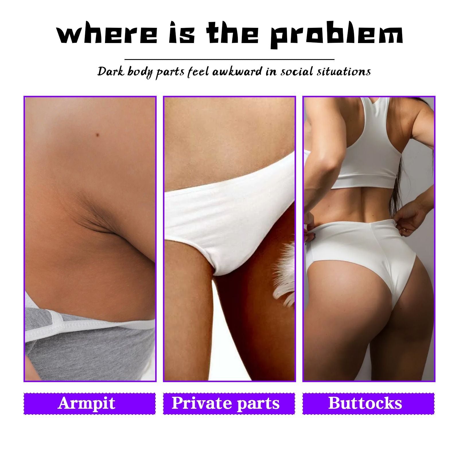 OUHOE Inner Thigh Skin Perfecting Cream – Brighten -Hallebeauty