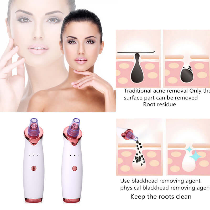 Blackhead Vacuum Suction Remover - Pore Cleaning Face Acne Tool for Beauty Skin Care - HalleBeauty